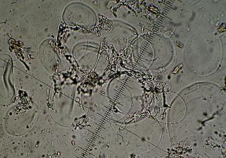 Stromatoscypha fimbriata 8 Pers.:Fr.)Donk